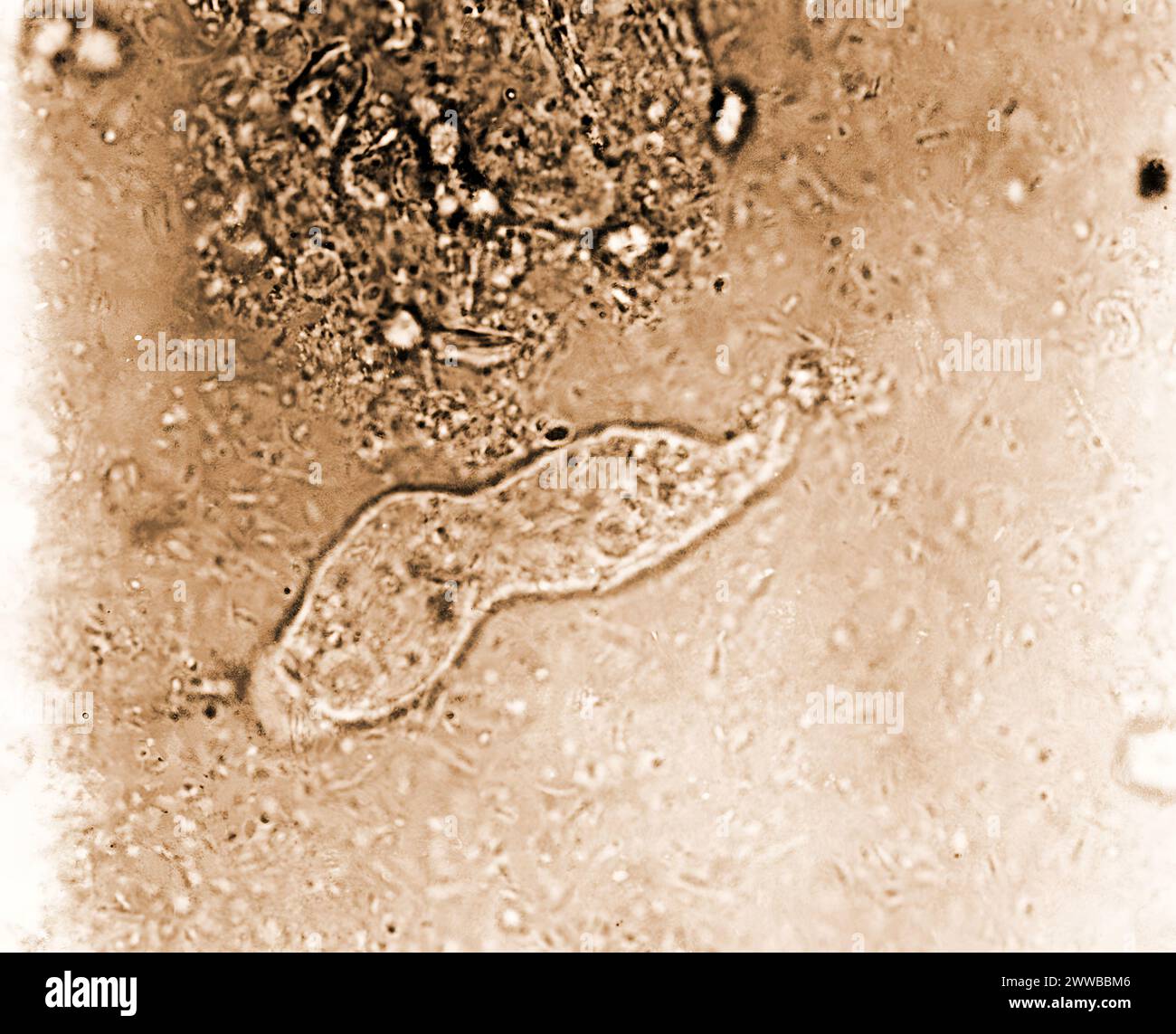 Dieser Photomikrograph zeigte das Vorhandensein eines Entamoeba histolytica trophozoiten, der hier während seines Lebens fotografiert wurde. Stockfoto