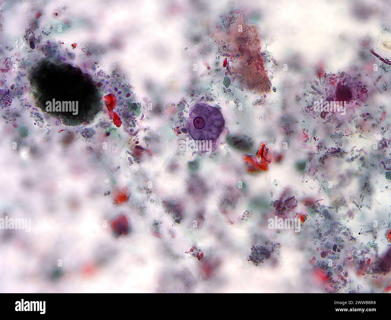 Mit Hilfe der Trichromfärbung zeigt dieser Photomikrograph einen Trophozoiten des einzelligen Parasiten Entamoeba histolytica. Stockfoto