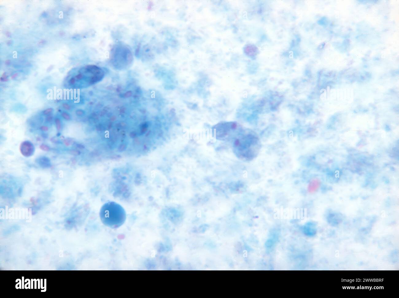Dieser Photomikrograph zeigte das Vorhandensein trichromgefärbter parasitärer Dientamoeba fragilis-Trophozoiten in dieser Probe. CDC 1970. Stockfoto