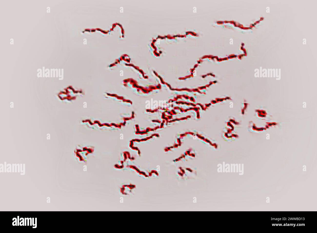 Borrelien - pathogene Bakterien (Spirochaetota) verantwortlich für Lyme-Borreliose, (Borrelia burgdorferi, Borrelia spielmanii. Stockfoto