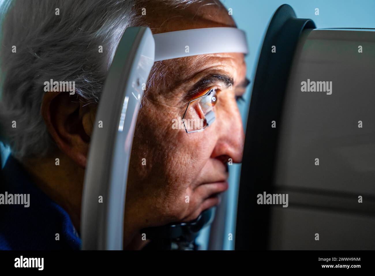 Nahaufnahme eines seriösen Seniorenmannes mit Augenöffner, der während einer Glaukomlaserbehandlung durch eine innovative Maschine schaut Stockfoto