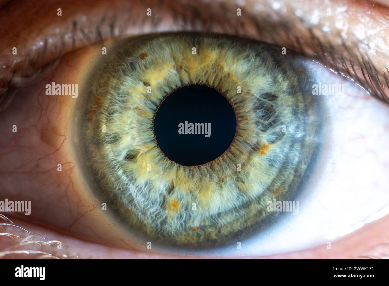 Beschreibung: Hochauflösendes grünblaues weibliches Auge mit gelben Pigmentflecken und weit geöffneter Pupille. Nahaufnahme. Strukturelle Anatomie. Menschliche Iris. Ma Stockfoto