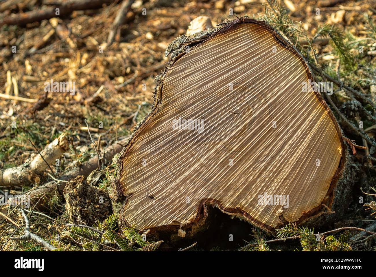 Forstwirtschaft. Birkenstümpfe nach Wintereinschlag im Frühjahr. Dichtes anormales Holz führt zu ungleichmäßigem Sägen Stockfoto