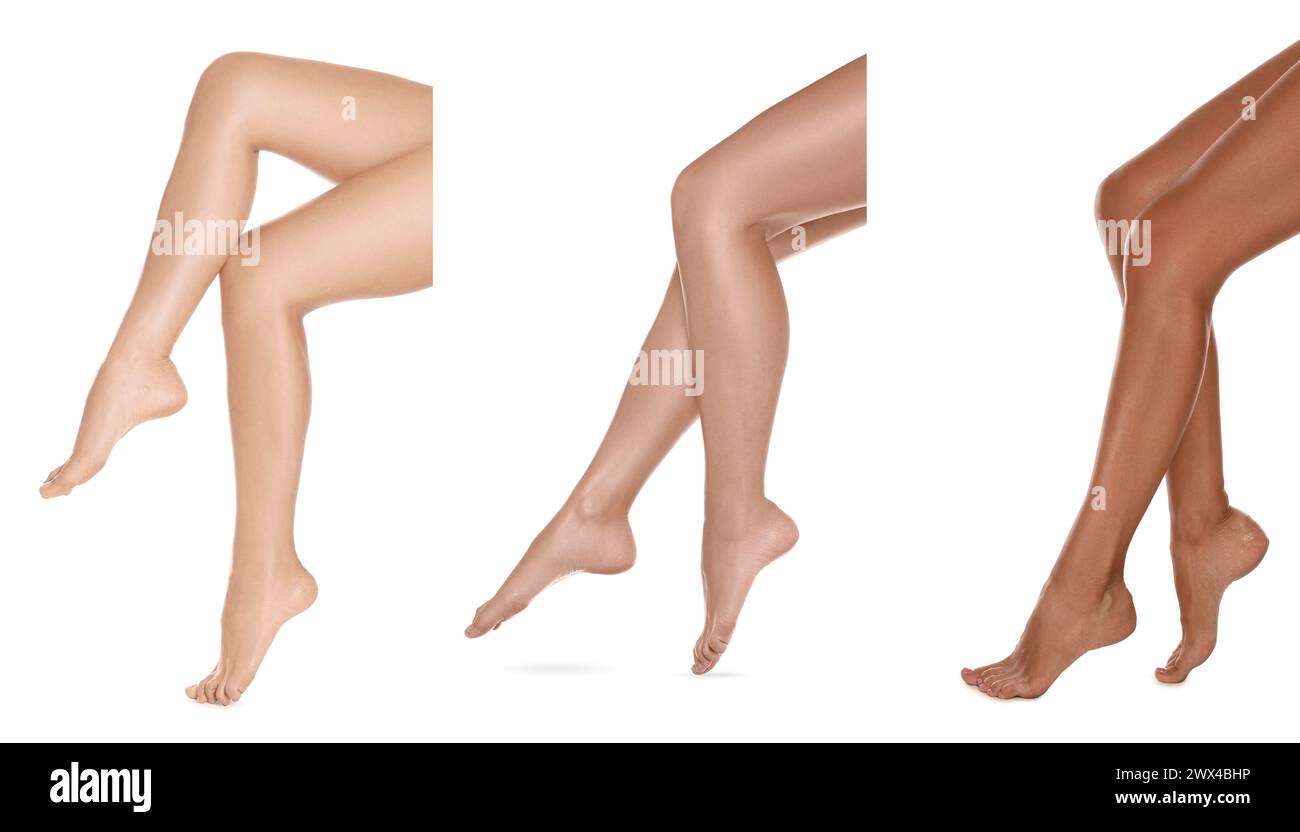 Frauen mit schönen Beinen auf weißem Hintergrund, Nahaufnahme. Collage von Fotos, die Stadien der Sonnenbräunung zeigen Stockfoto