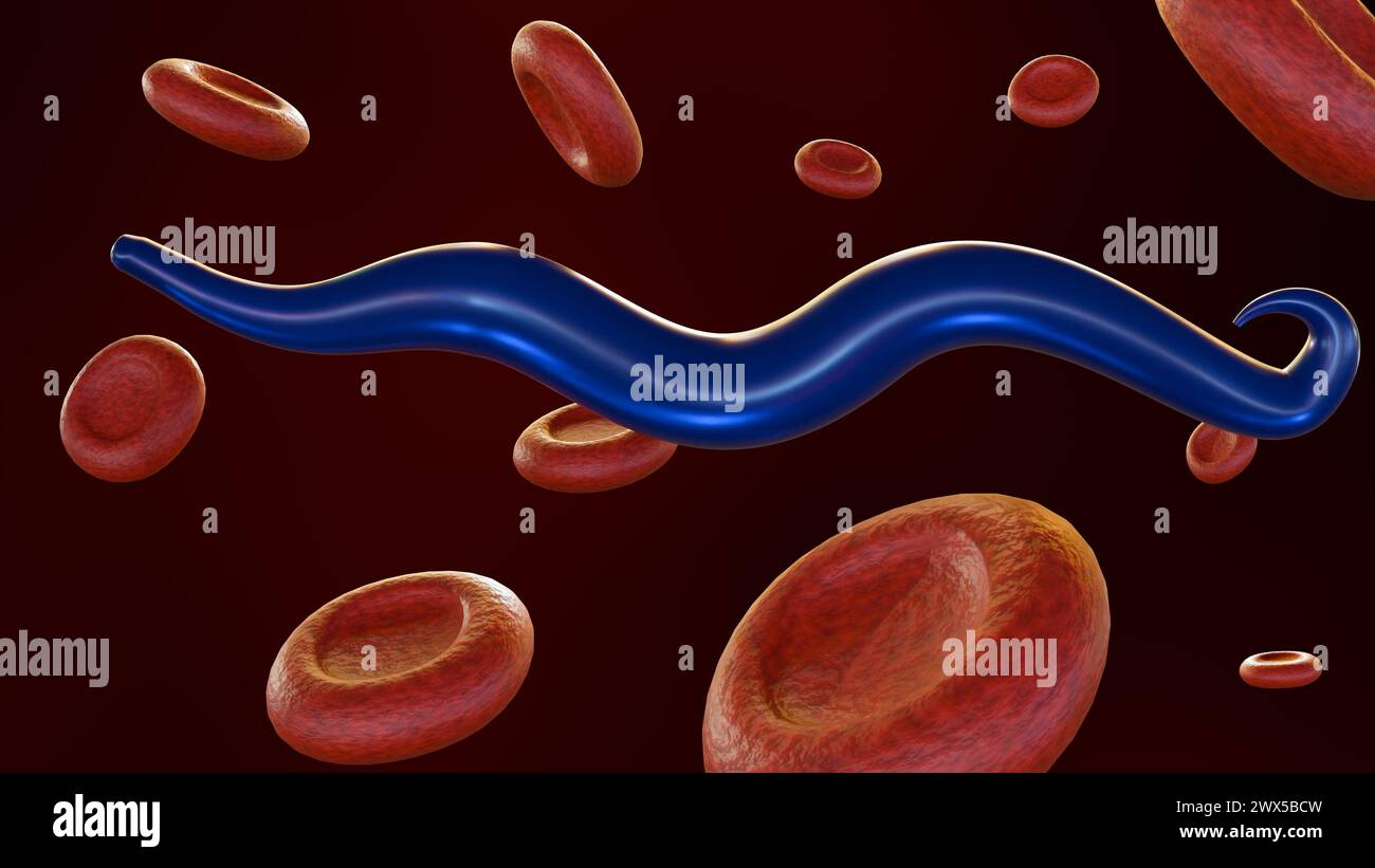 3D-Darstellung der mit Plasmodium falciparum infizierten roten Blutkörperchen Stockfoto