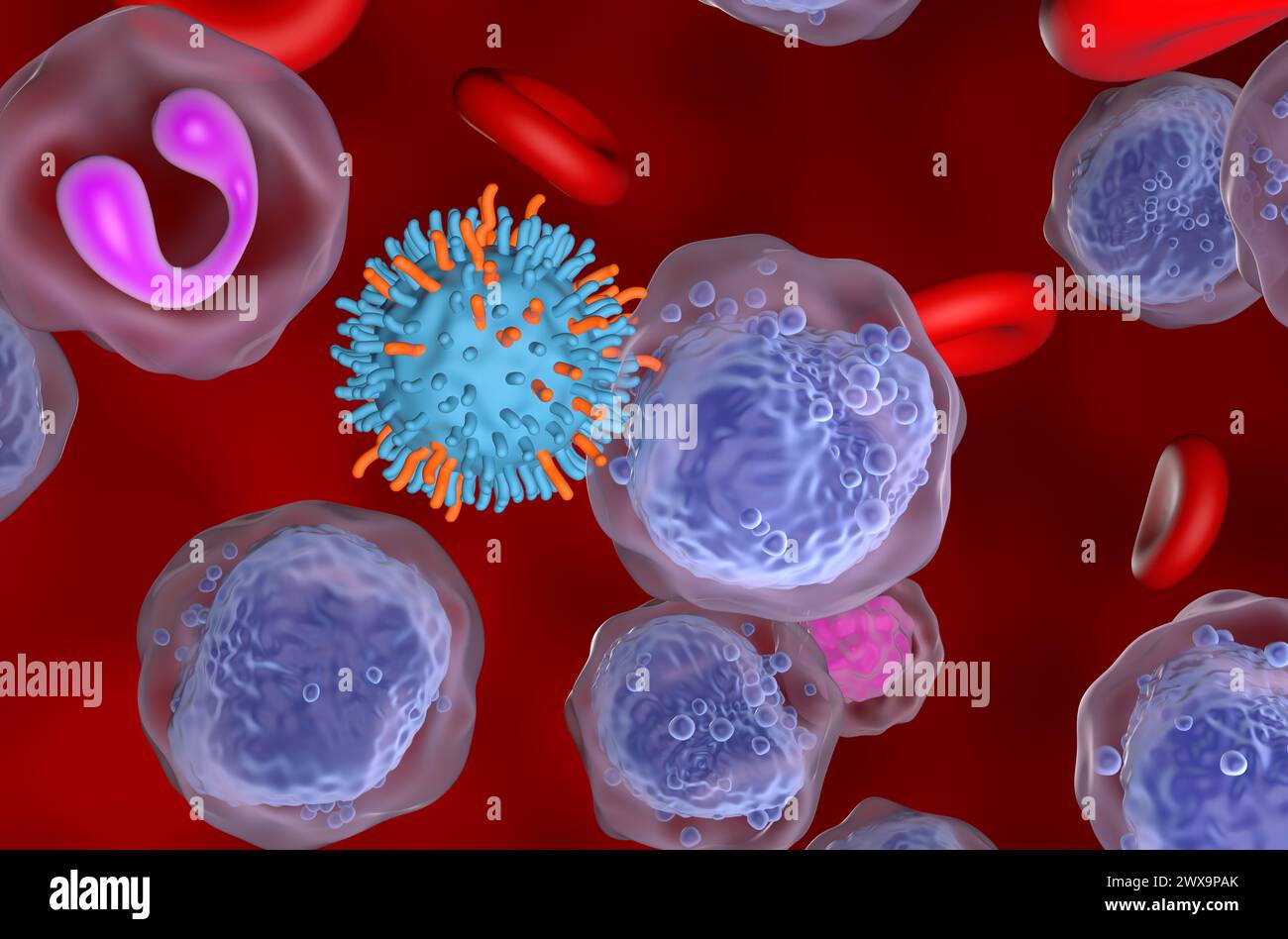 CAR-T-Zell-Therapie bei akuter myeloischer Leukämie (AML) - Nahaufnahme 3D-Illustration Stockfoto