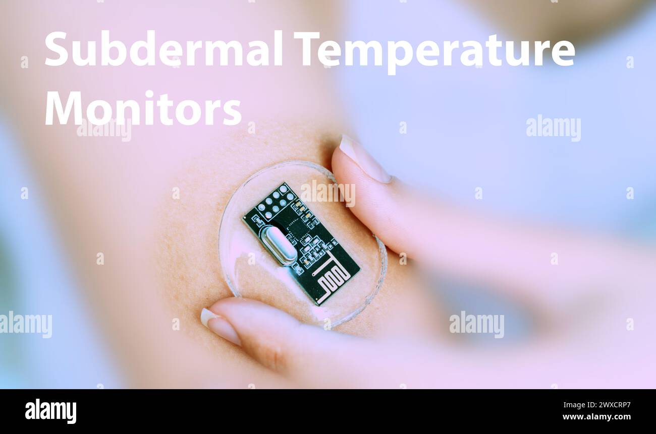 Subdermale Temperaturmonitore, Konzeptbild. Implantierbare Sensoren zur kontinuierlichen Messung der Körpertemperatur zur Überwachung von Fieber oder temperaturbedingten Bedingungen. Stockfoto