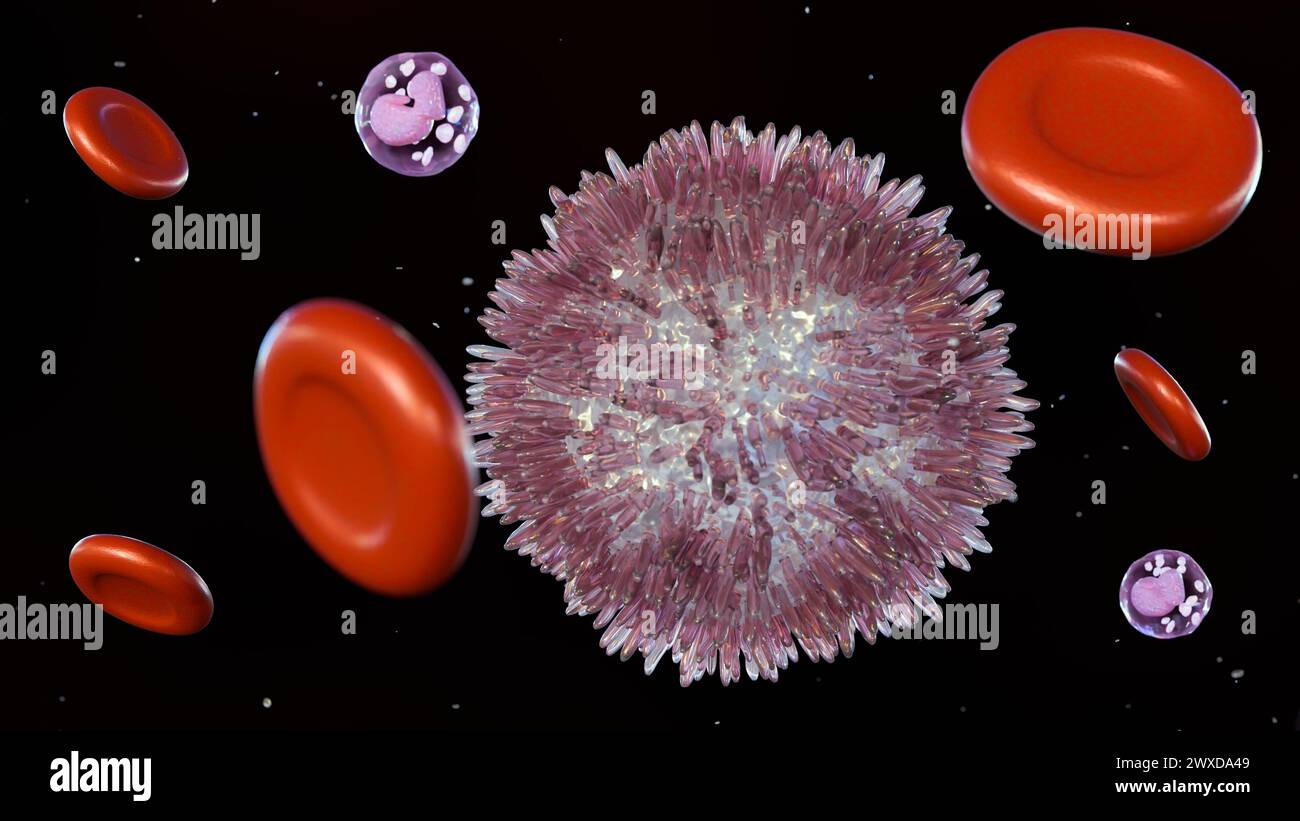 Die 3D-Darstellung der Haargellleukämie (HCL) ist eine seltene Form der chronischen Leukämie, die sich langsam aus weißen Blutkörperchen, den sogenannten B-Lymphozyten, entwickelt. Stockfoto