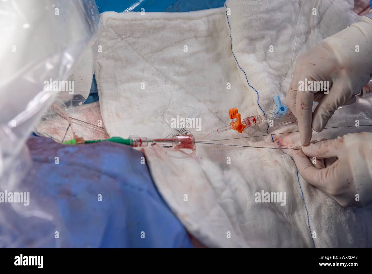 Interventionelle Kardiologie. Chirurgenarzt bei der Operation. Stent