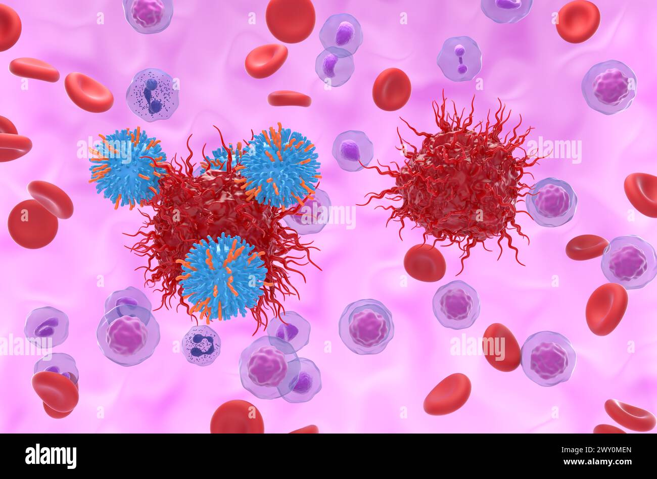 CAR-T-Zell-Therapie bei neuroendokrinem Tumor (NET) - isometrische Darstellung 3D-Illustration Stockfoto