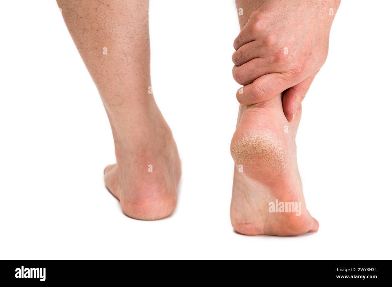 Männlicher Fuß isoliert auf weißem Hintergrund Stockfoto