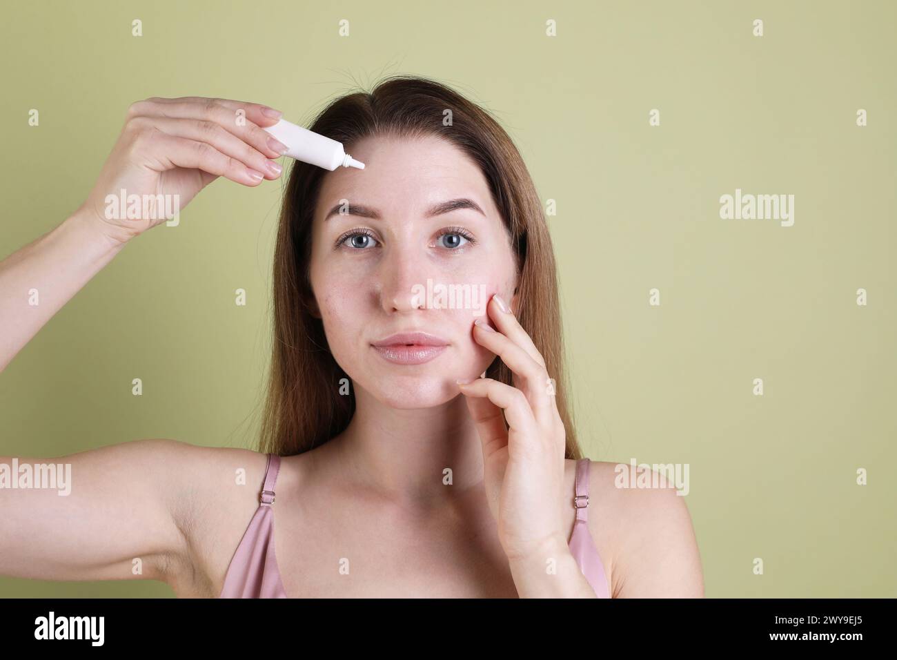 Junge Frau mit Akneproblem, die kosmetisches Produkt auf ihre Haut auf olivem Hintergrund aufträgt Stockfoto