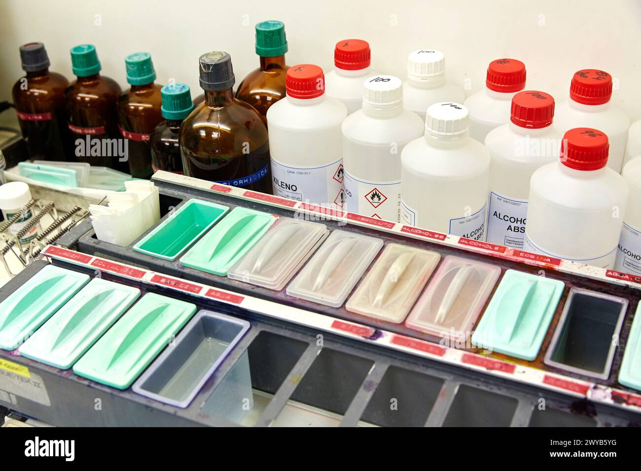Zytologie, Anatomische Pathologie, Krankenhaus Donostia, San Sebastian, Gipuzkoa, Baskenland, Spanien. Stockfoto