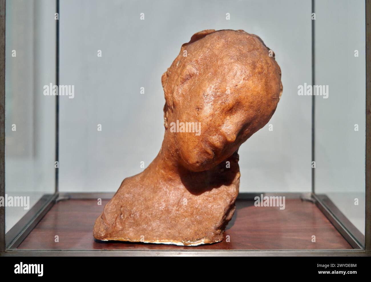 Kranker Junge, 1889-1892, Medardo Rosso (1858-1928). Stockfoto