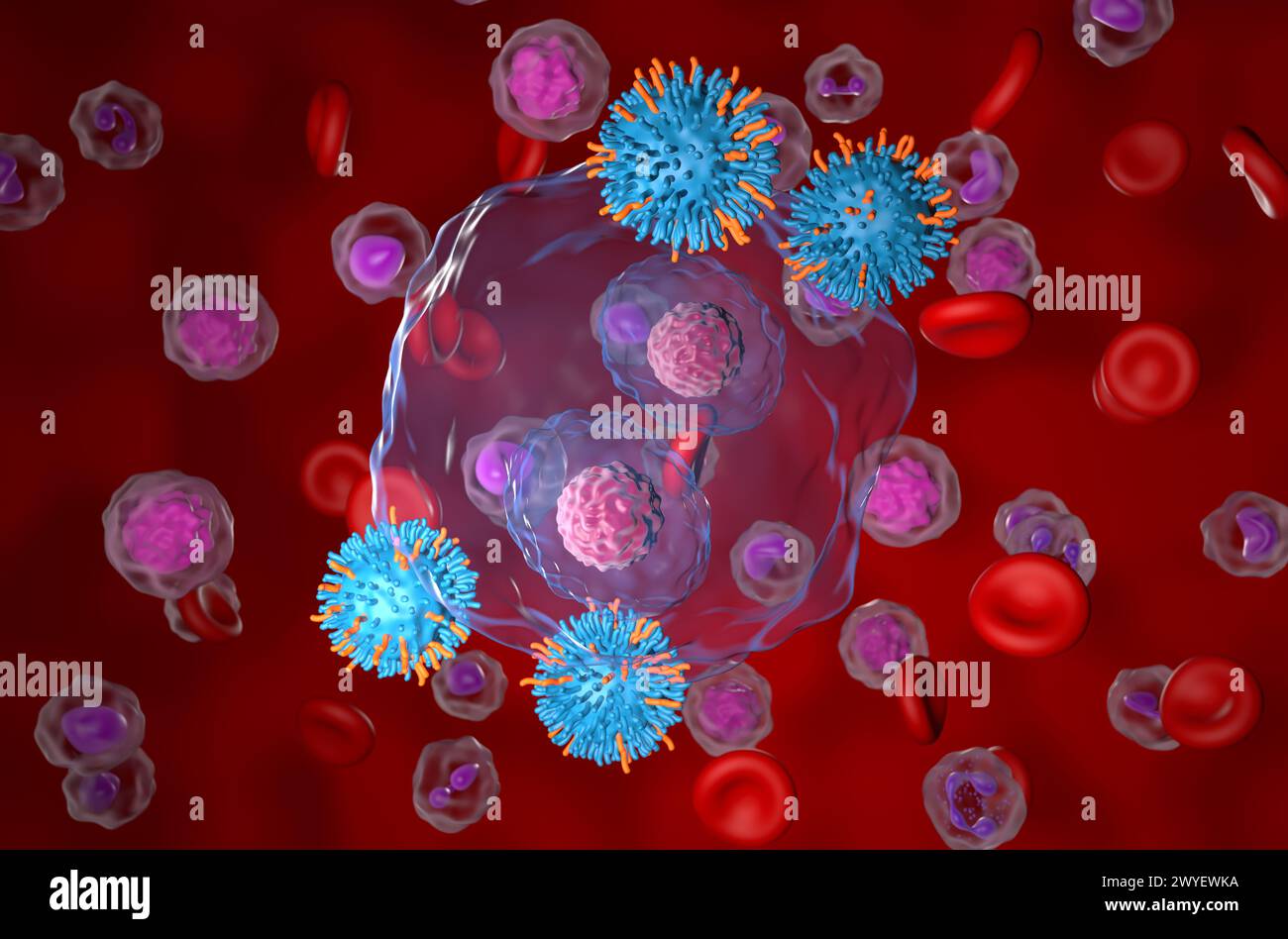 CAR-T-Zell-Therapie beim Hodgkin-Lymphom (HL) - Nahaufnahme 3D-Illustration Stockfoto