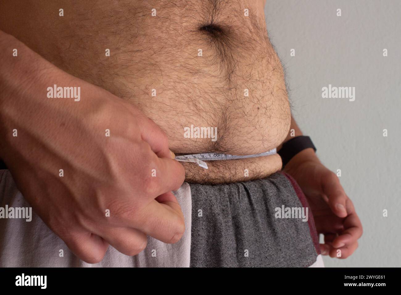 Erleben Sie die Reise eines übergewichtigen Mannes, der sich um seine Gesundheit kümmert und seine Taille mit Entschlossenheit zwischen sichtbaren Dehnungsstreifen misst Stockfoto