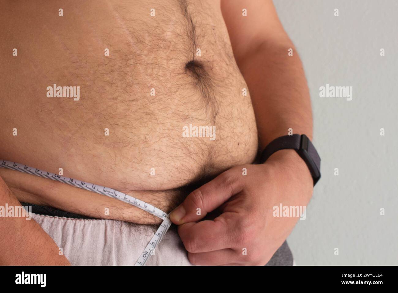 Erleben Sie die Reise eines übergewichtigen Mannes, der sich um seine Gesundheit kümmert und seine Taille mit Entschlossenheit zwischen sichtbaren Dehnungsstreifen misst Stockfoto