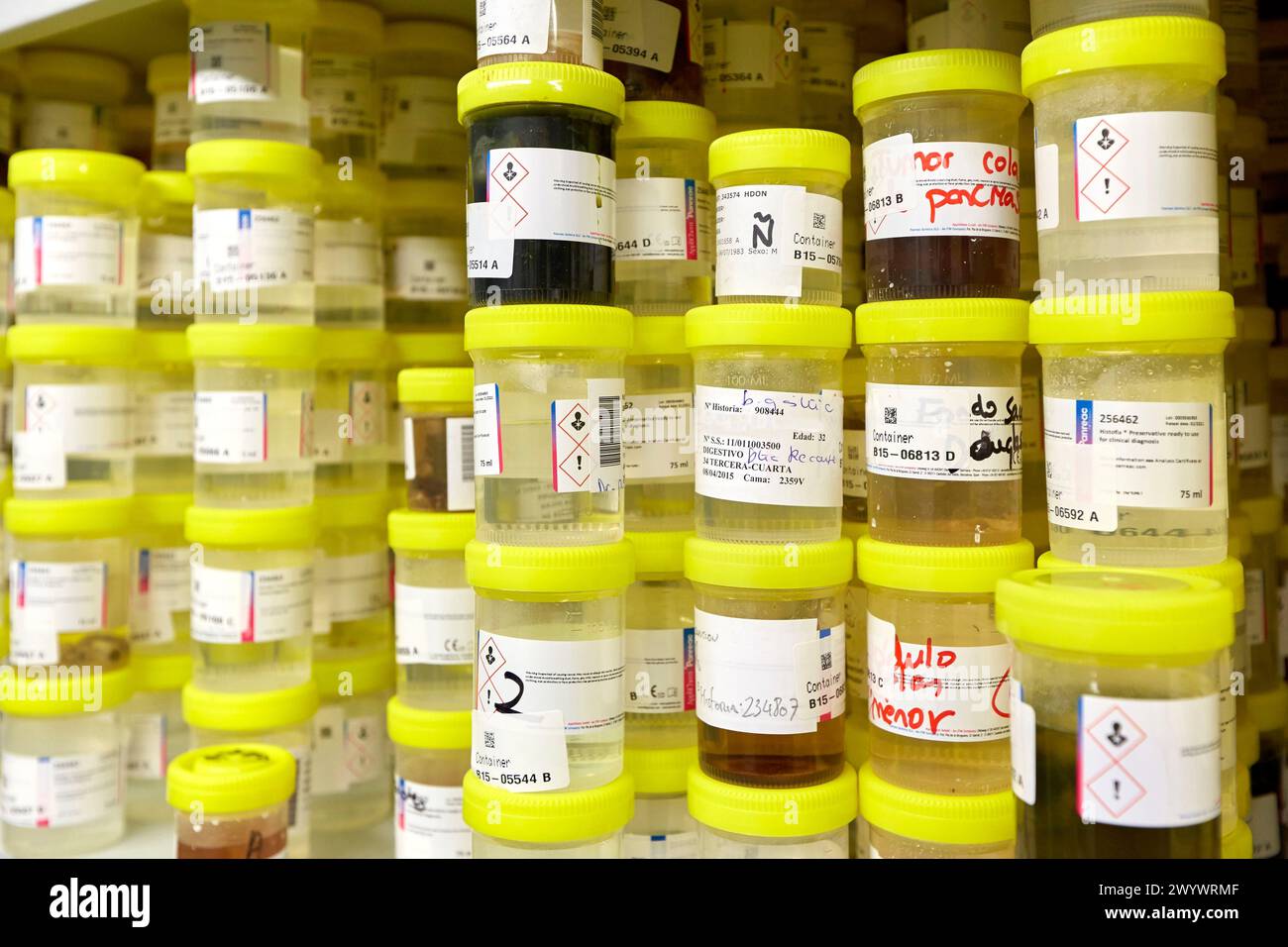 Probenlagerung, Anatomische Pathologie, Krankenhaus Donostia, San Sebastian, Gipuzkoa, Baskenland, Spanien. Stockfoto