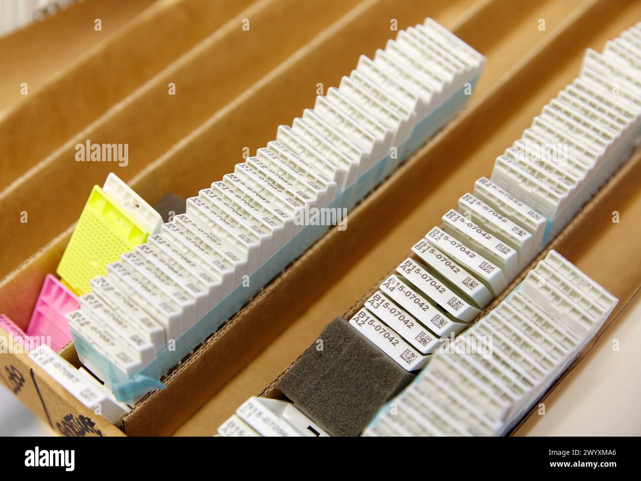 Makros-Bereich, Carving, Anatomische Pathologie, Krankenhaus Donostia, San Sebastian, Gipuzkoa, Baskenland, Spanien. Stockfoto