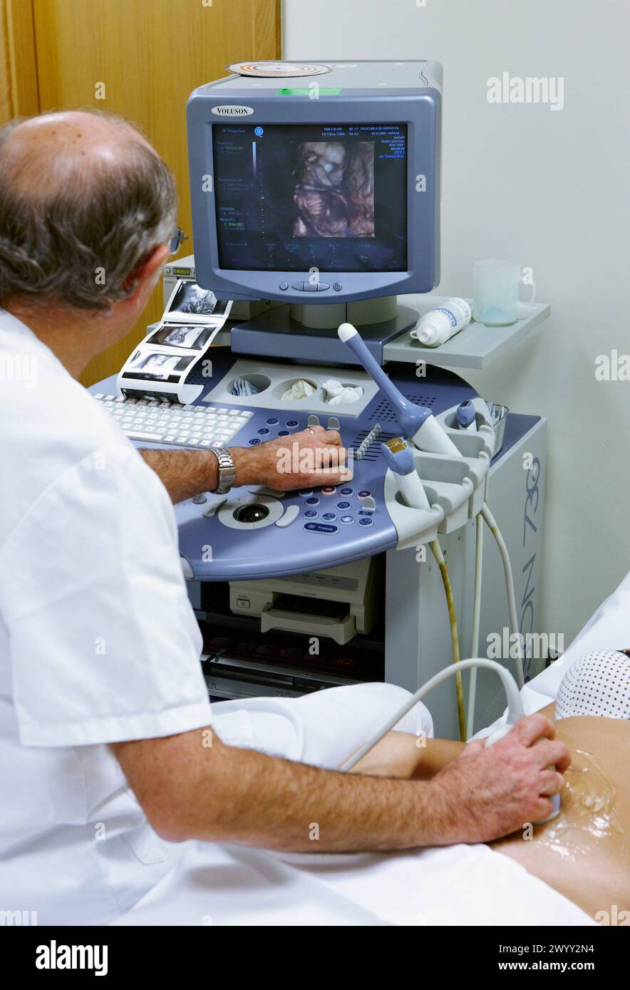 3D geburtshilflicher Ultraschall eines Fetus, 4D Baby Scan zeigt Bewegung, Gynäkologie, Krankenhaus Policlinica Gipuzkoa, San Sebastian, Donostia, Euskadi, Spanien. Stockfoto