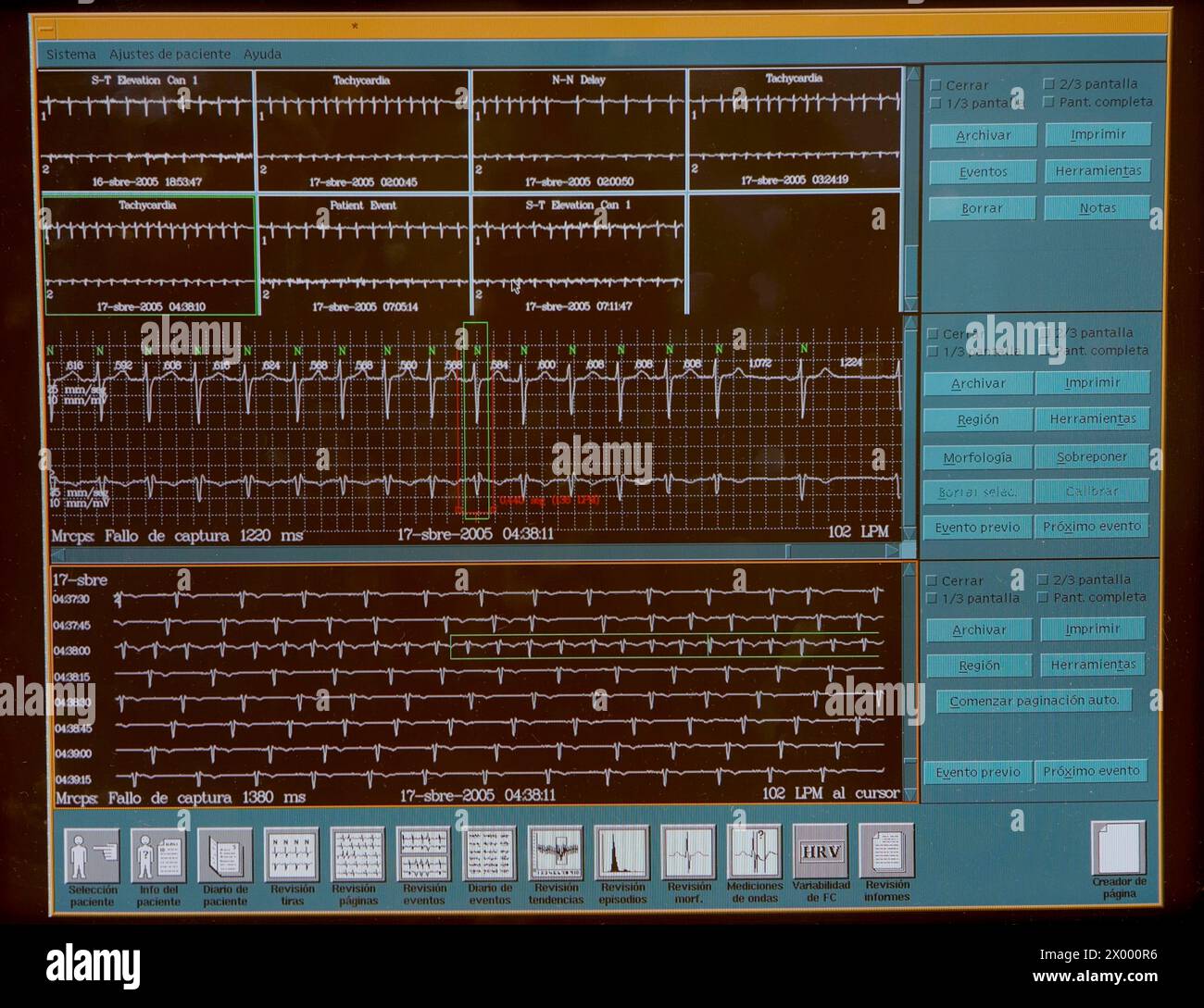 Holter-Monitoring, Hämodynamik. Krankenhaus Universitario Gran Canaria Arzt Negrin, Las Palmas de Gran Canaria. Kanarische Inseln, Spanien. Stockfoto