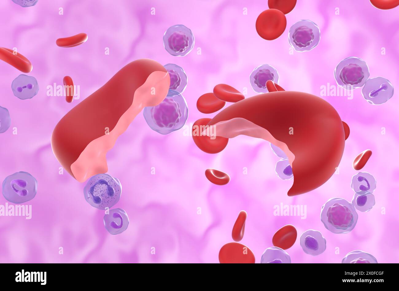 Hämolytische Anämie (HA) Zellen im Blutfluss - Nahaufnahme 3D Illustration Stockfoto