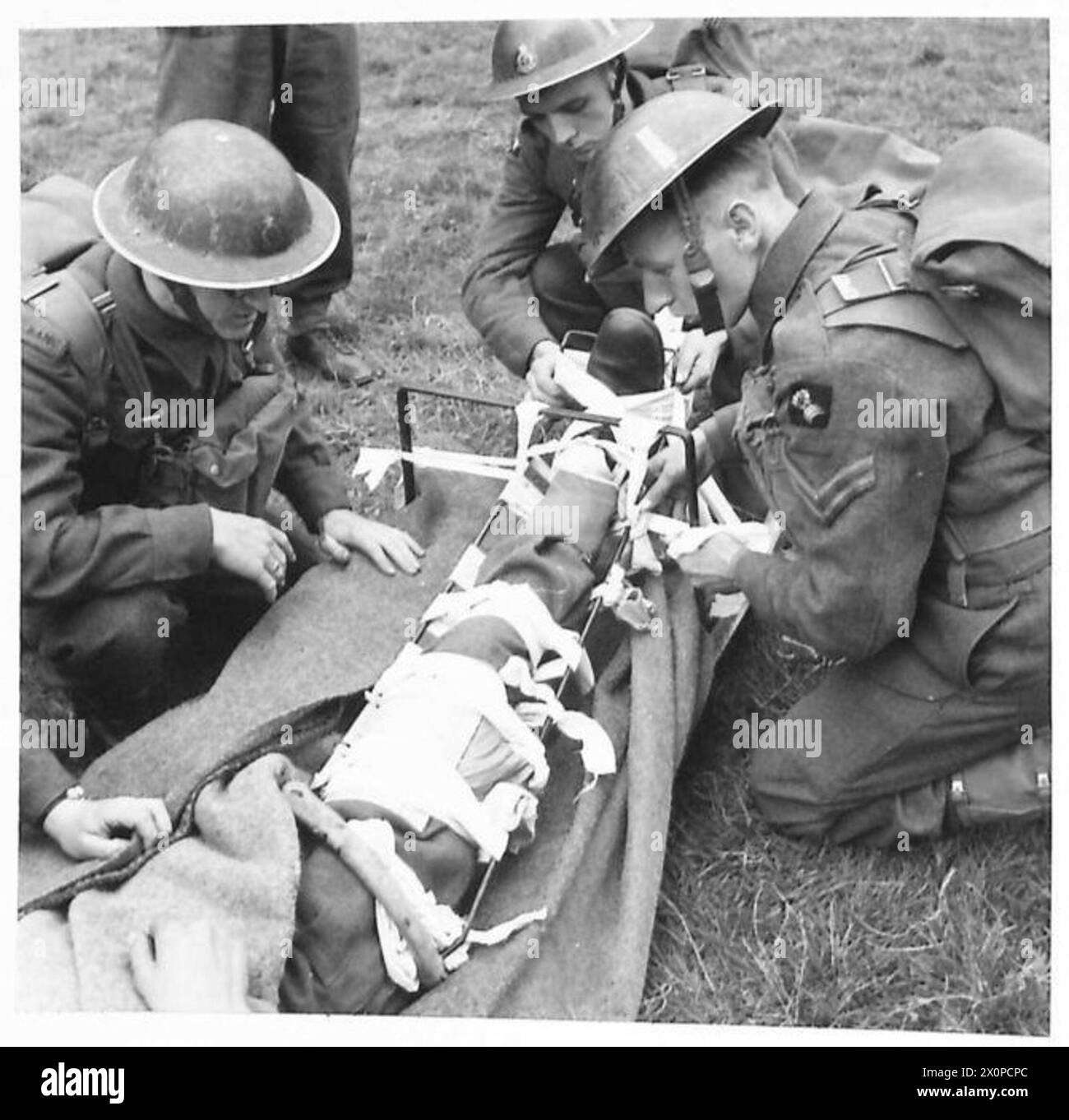 ÄRZTLICHE DIENSTE - verschiedene Stadien der Anwendung des Thomas-Schienen-Fotonegativ , British Army Stockfoto