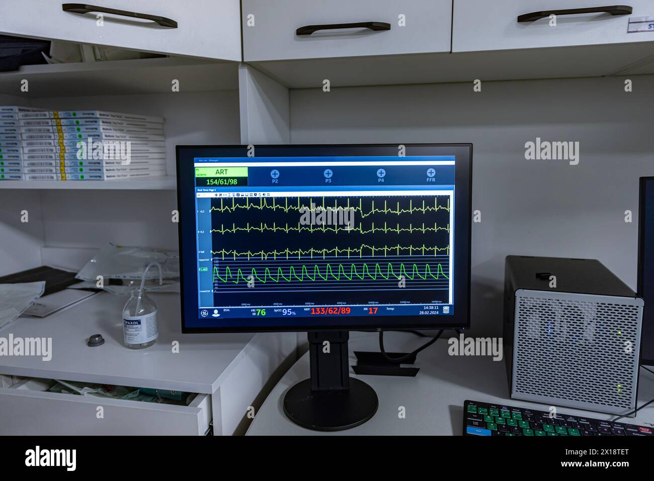 Denizli, Türkei - 28. Februar 2024; Monitor mit Vitalparametern und EKG-Daten des Patienten während der Operation im OP im Krankenhaus. Zeigt p Stockfoto