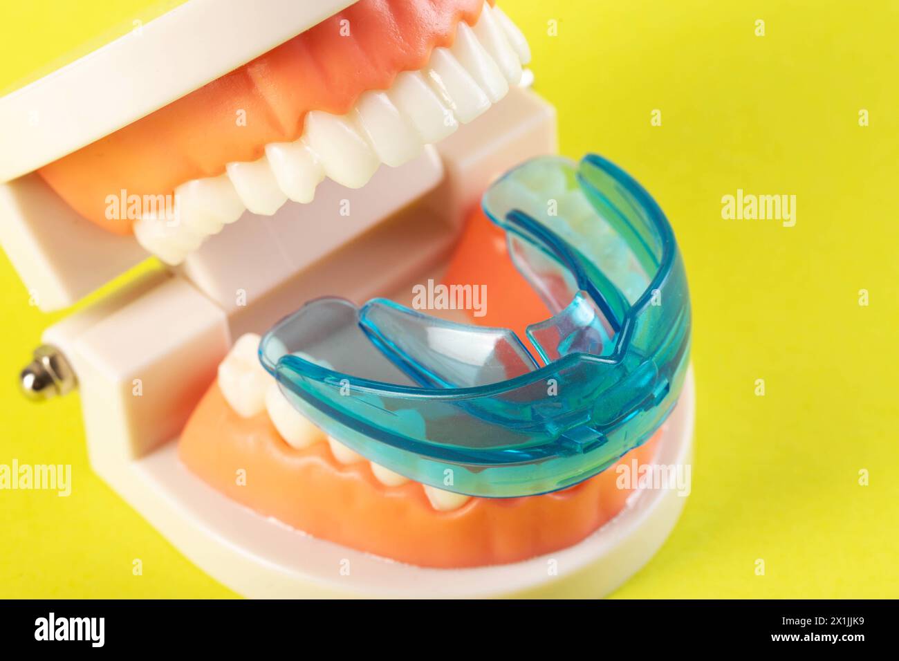 Therapeutischer Mundschutz auf dem Hintergrund eines Kiefermodells auf gelbem Hintergrund. Behandlung von Zahnschleifen, Bruxismus bei Kindern und Erwachsenen. P Stockfoto