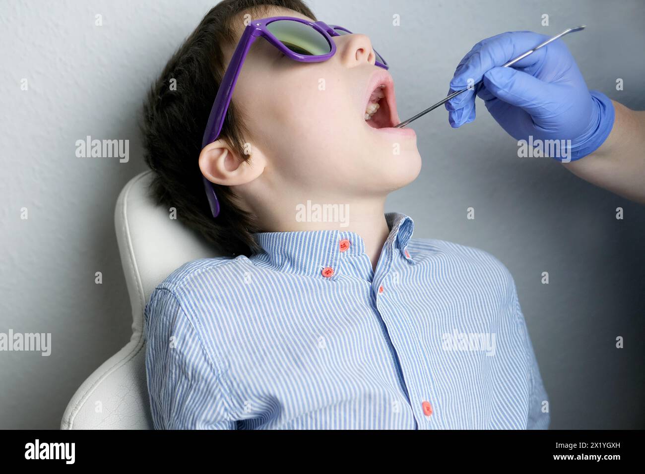 Zahnarzt, Arzt untersucht die Mundhöhle eines kleinen Patienten, Backenzähne wachsen, Junge, Kind mit offenem Mund, Nahaufnahme der Zähne des Kindes Stockfoto