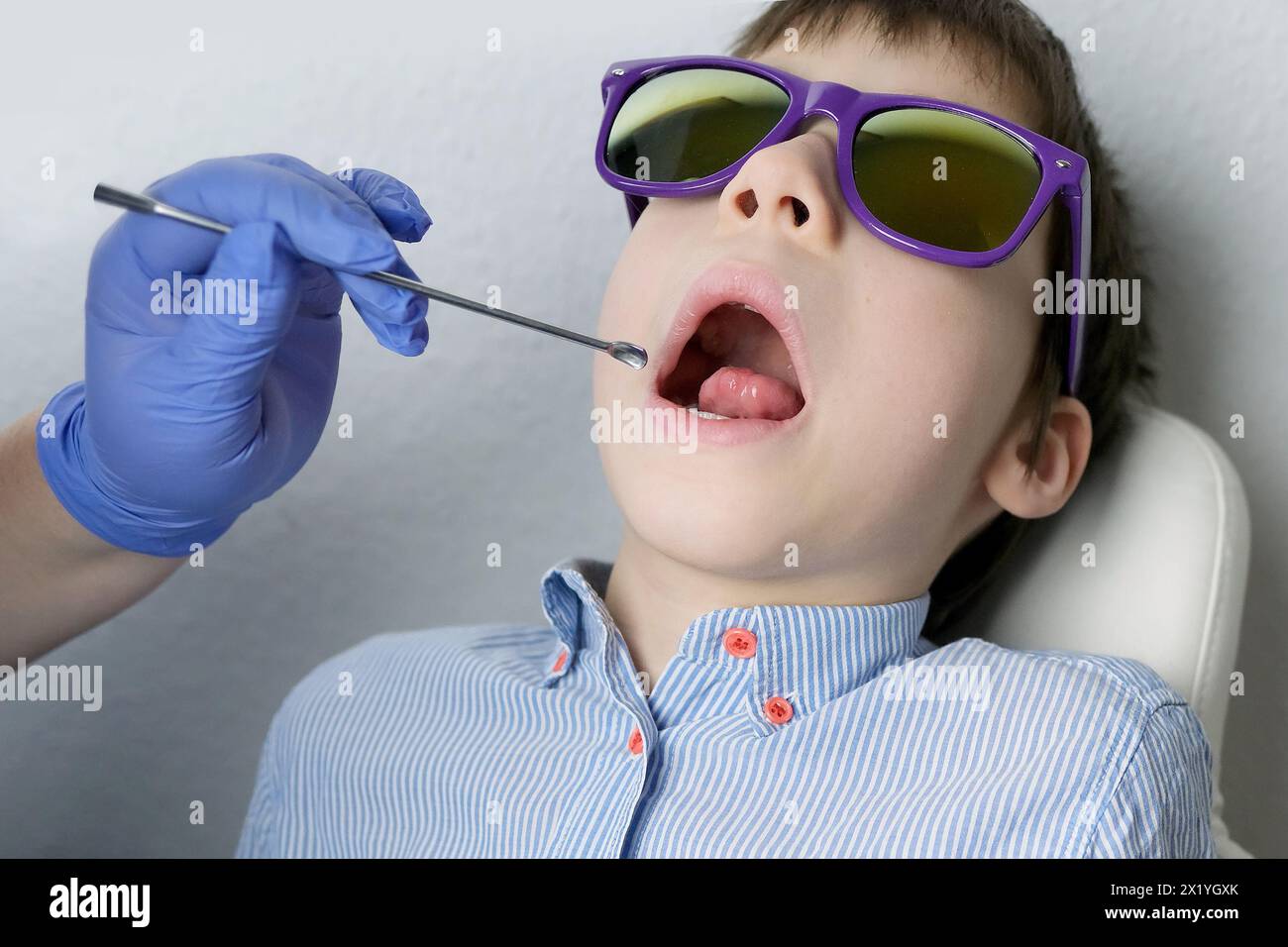Zahnarzt, Arzt untersucht die Mundhöhle eines kleinen Patienten, Backenzähne wachsen, Junge, Kind mit offenem Mund, Nahaufnahme der Zähne des Kindes Stockfoto