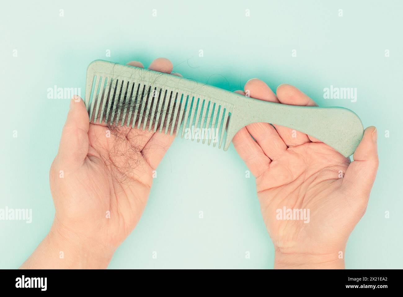 Kamm mit Haarausfall, Gesundheitsproblem, Problem des Alterns, Alopecia areata durch Stress oder Infektion, Haarbürste Stockfoto