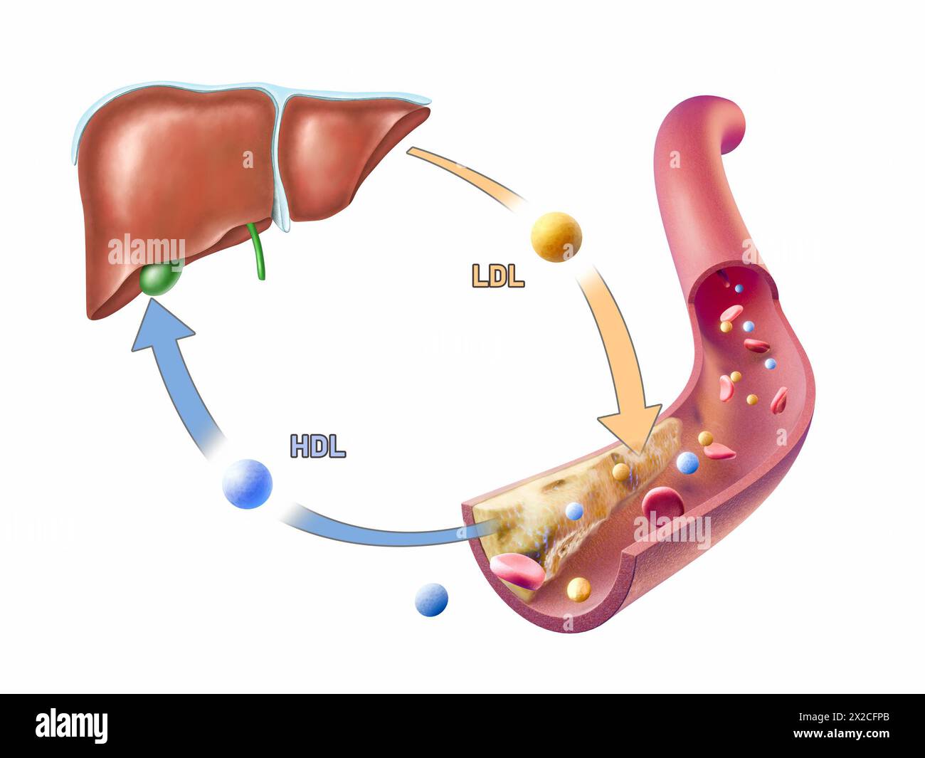 Lipoproteine mit hoher Dichte und niedriger Dichte, die Cholesterin hinzufügen und aus einer arteriellen Plaque entfernen. Digitale Illustration, 3D-Rendering. Stockfoto