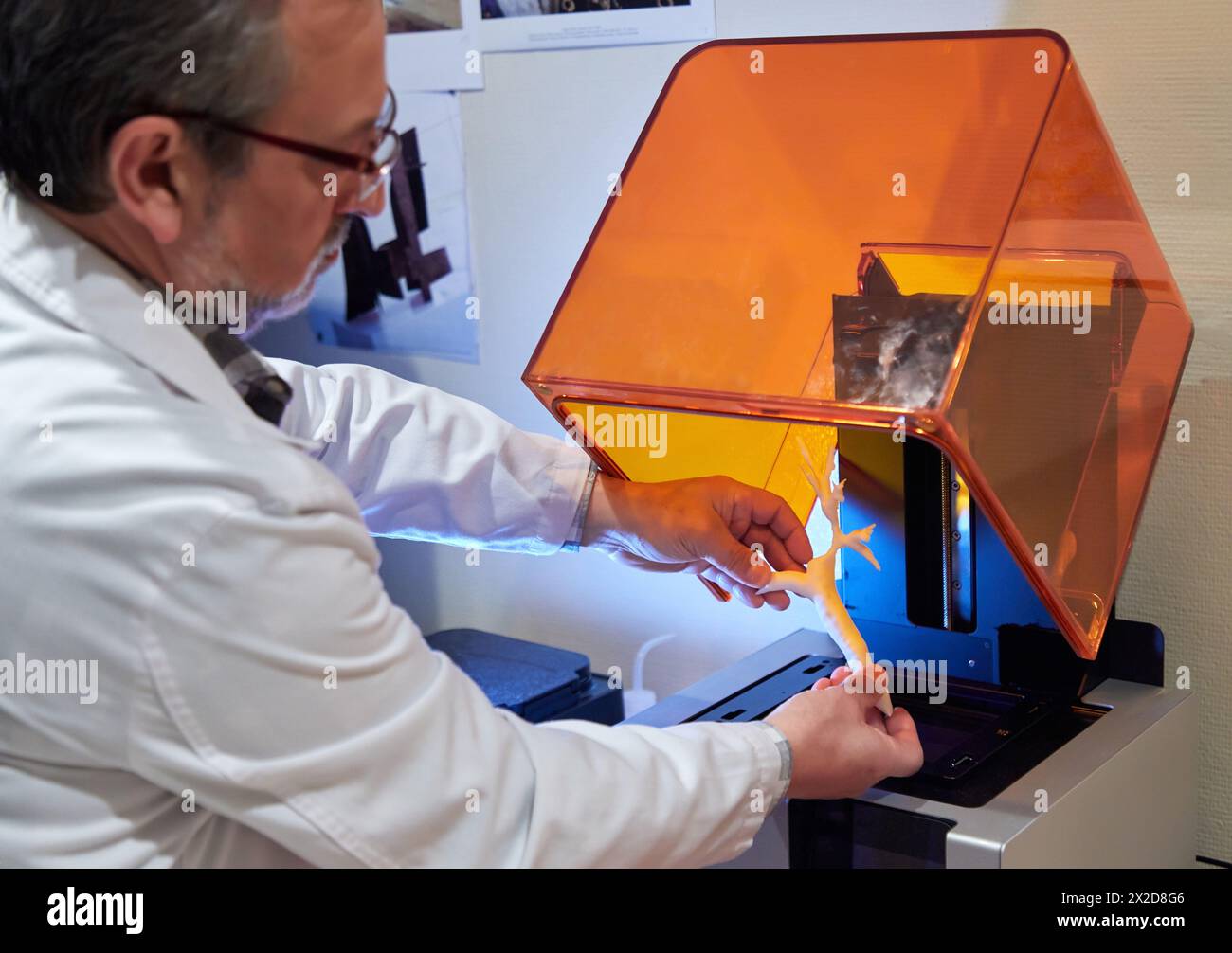 3D-Eindruck der Luftröhre eines Patienten von einem medizinischen Bild, 3D-Drucker, Additivtechnologien PolyJet oder FDM für Rapid Prototyping, Radiologie, Hos Stockfoto