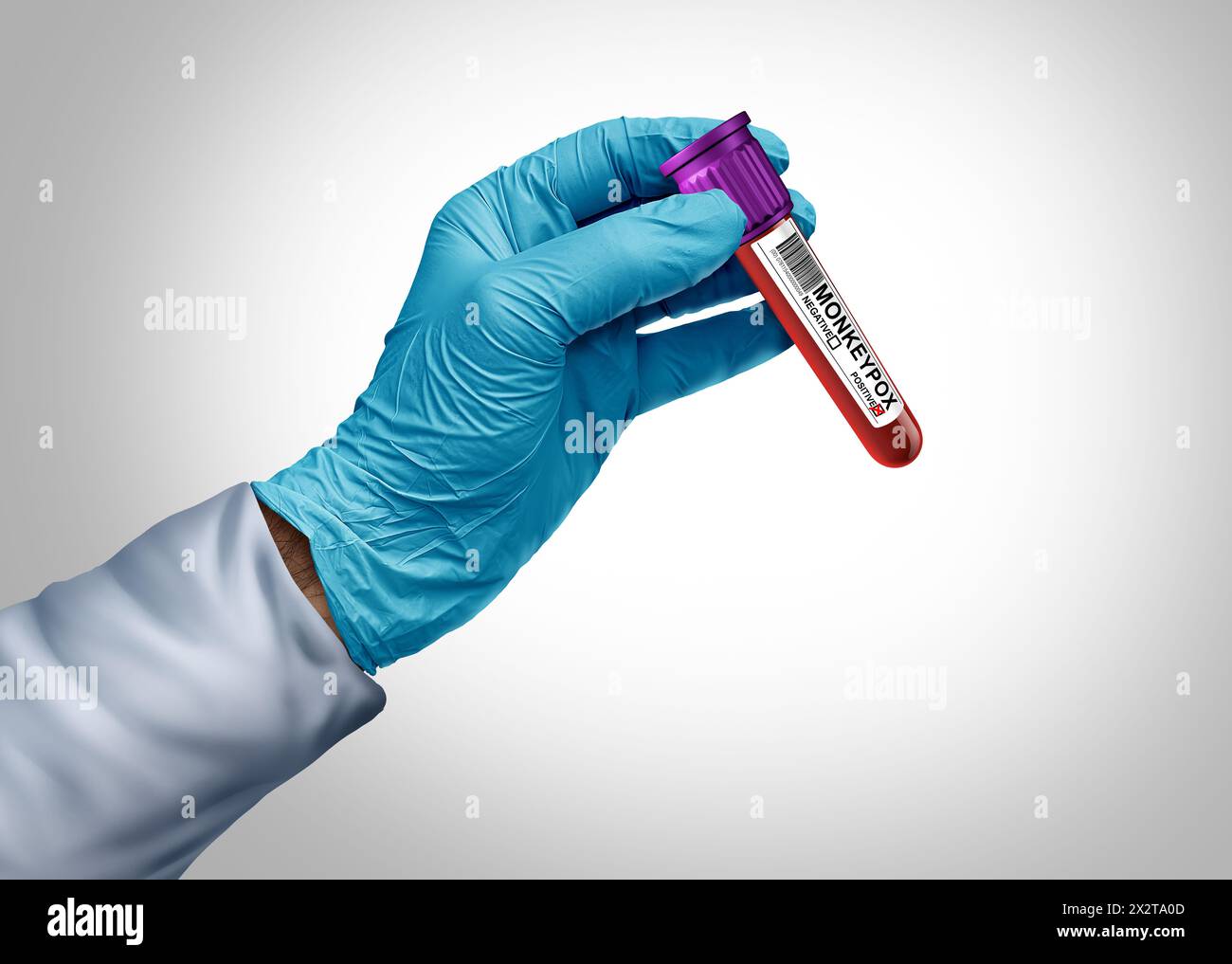 Affenpocken-Virus-Ausbruch oder Mpocken-Krankheit-Pandemie als Arzt oder Wissenschaftler, der infiziertes Blut mit viralen Erregern, die den Menschen als Virologie infizieren, testet Stockfoto