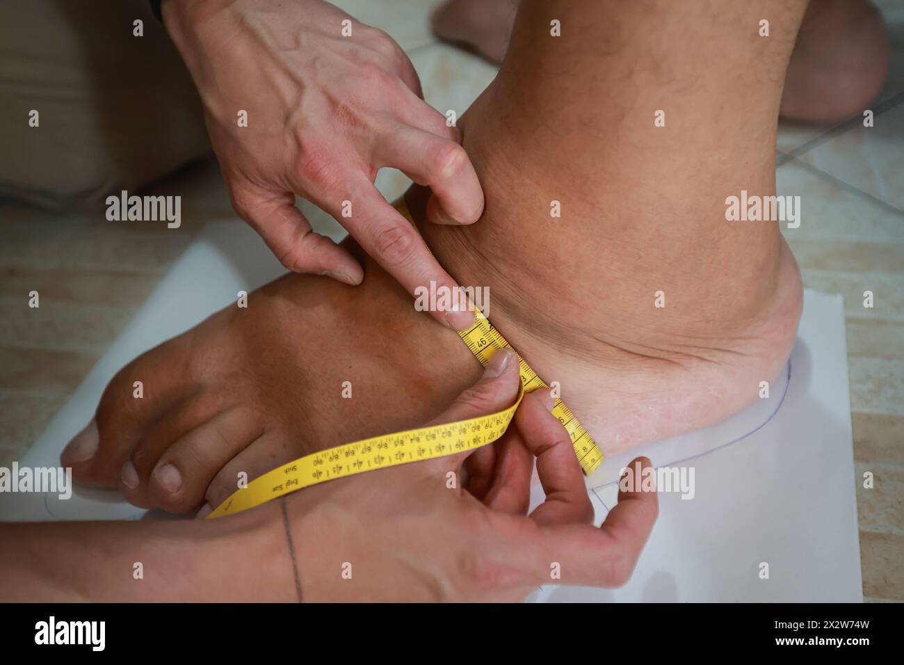 Maracay, Venezuela. April 2024. Adrian Wessels misst den Fuß des venezolanischen Jeison Rodriguez. Rodriguez, dessen Füße mehr als 40 Zentimeter lang sind, wurde vom deutschen Schuhmacher Georg Wessels mit Spezialschuhen versehen. Quelle: Jesus Vargas/dpa/Alamy Live News Stockfoto