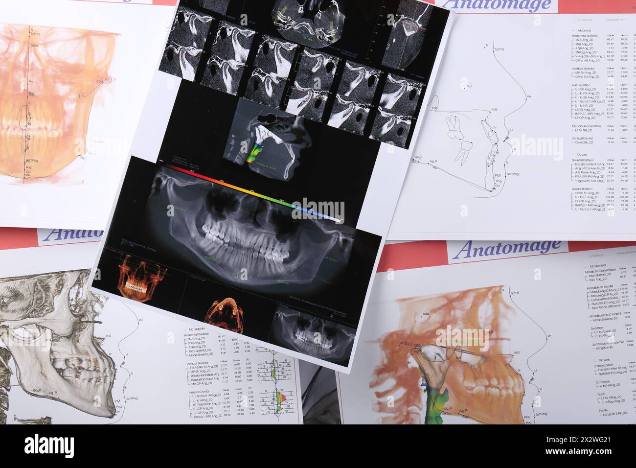 Panorama-Röntgen- und Zahnanatomie-Diagramme als Hintergrund, Draufsicht Stockfoto