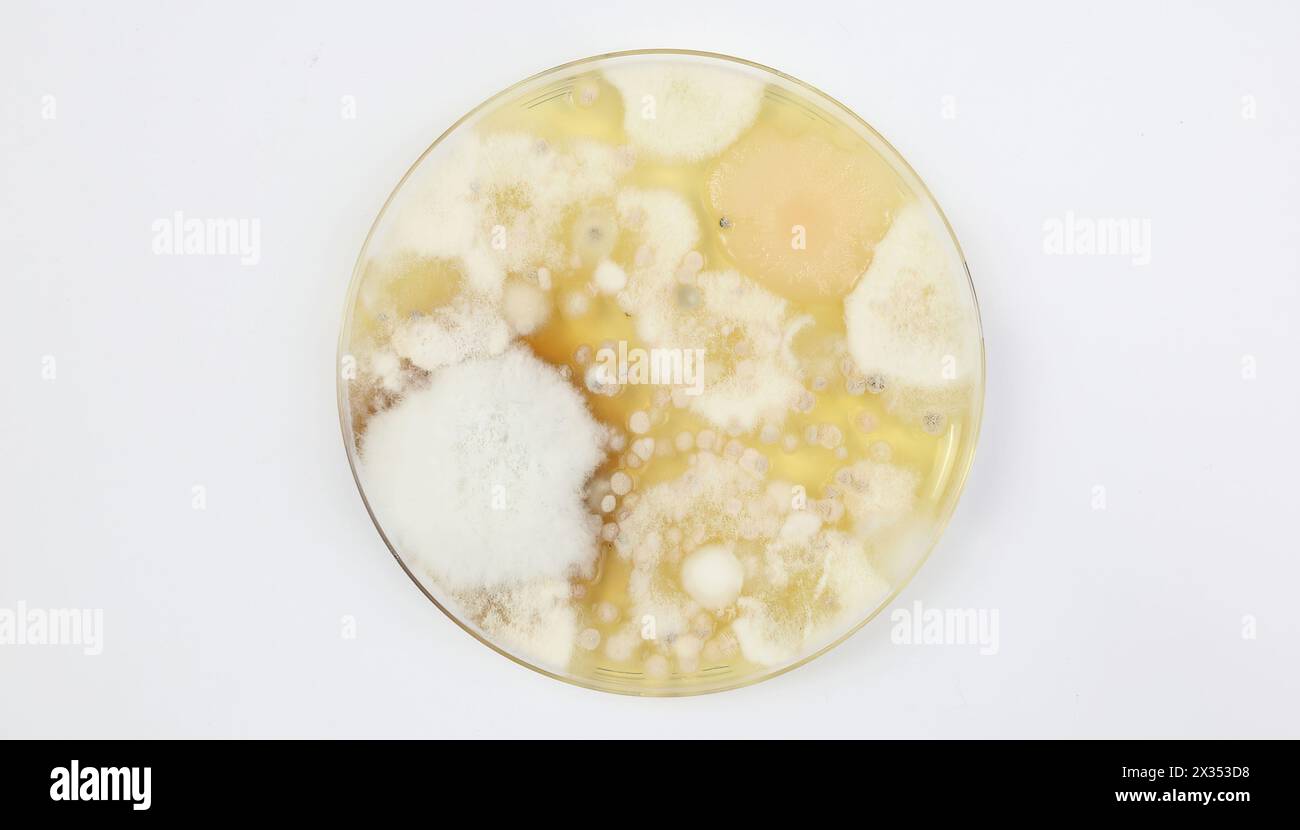 Schimmeltest Petrischalen-Agar-Plattenkulturmedium mit verschiedenen weißen Sporenkolonien (Fokus auf Mitte) Stockfoto