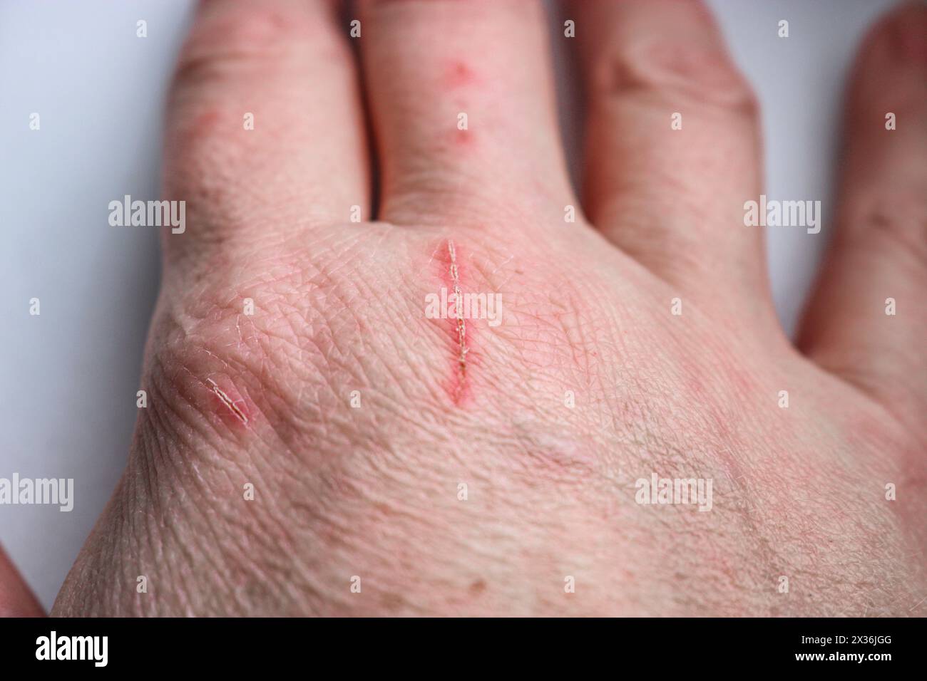Nahaufnahme der zerkratzten Hand eines Tierbesitzers. Selektiver Fokus Stockfoto