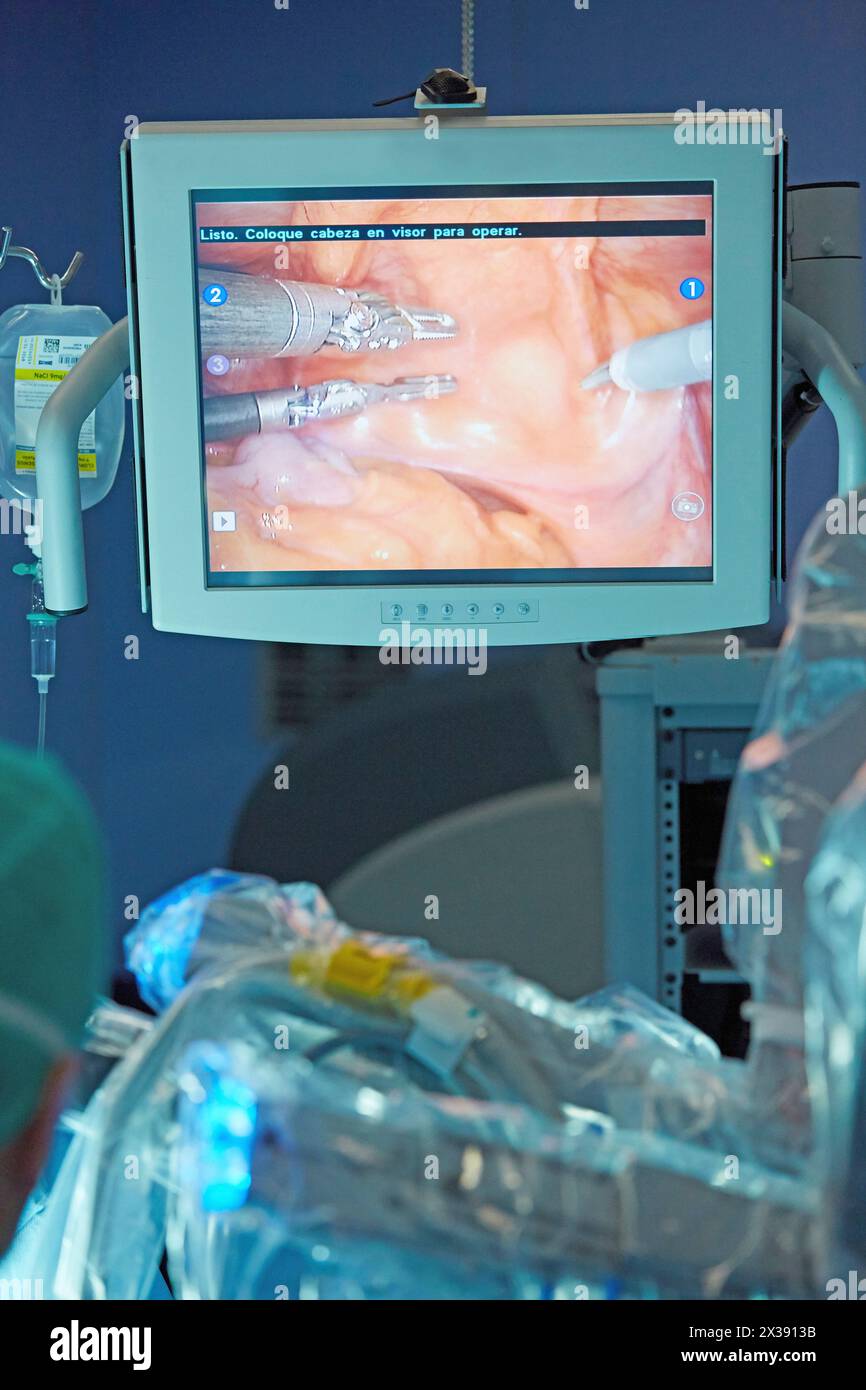 Operationssaal, Prostatakrebs Roboterchirurgie, da Vinci chirurgischer Roboter, Urologie, Krankenhaus Donostia, San Sebastian, Gipuzkoa, Baskenland, Spanien Stockfoto