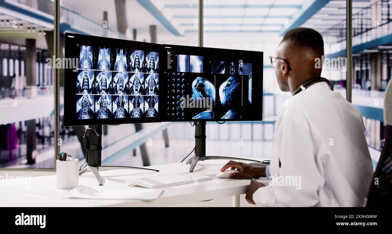 Arzt Screening Knie Knochen X Ray am Computer Stockfoto
