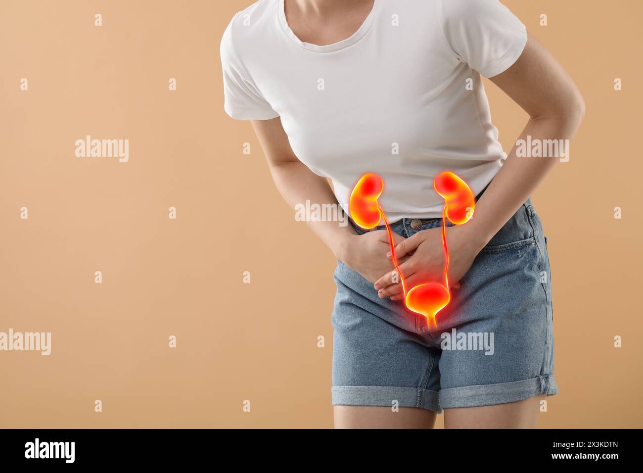 Frau mit Zystitis auf beigefarbenem Hintergrund, Nahaufnahme. Illustration des Harnsystems Stockfoto