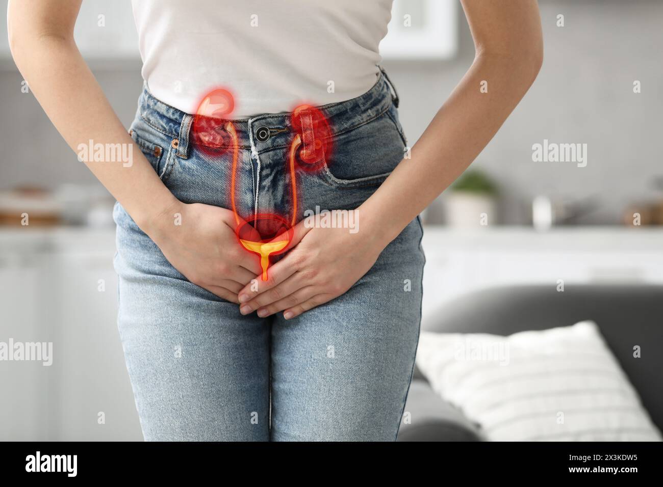 Frau, die zu Hause an Zystitis leidet, Nahaufnahme. Illustration des Harnsystems Stockfoto