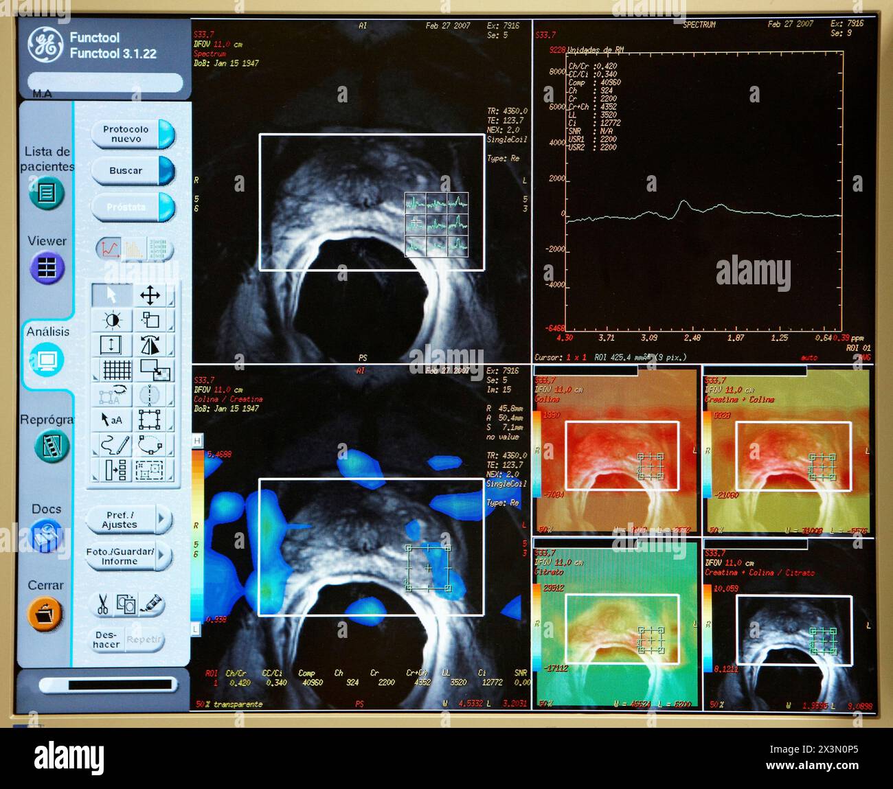 Prostatitis Cat Prostate anatomy -Fotos und -Bildmaterial in hoher Auflösung – Alamy