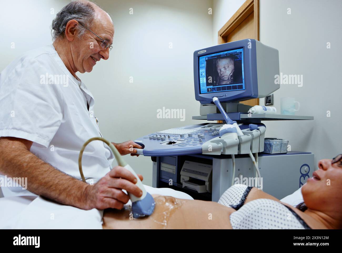 3D geburtshilflicher Ultraschall eines Fetus, 4D Baby Scan zeigt Bewegung, Gynäkologie, Krankenhaus Policlinica Gipuzkoa, San Sebastian, Donostia, Euskadi, Spanien Stockfoto