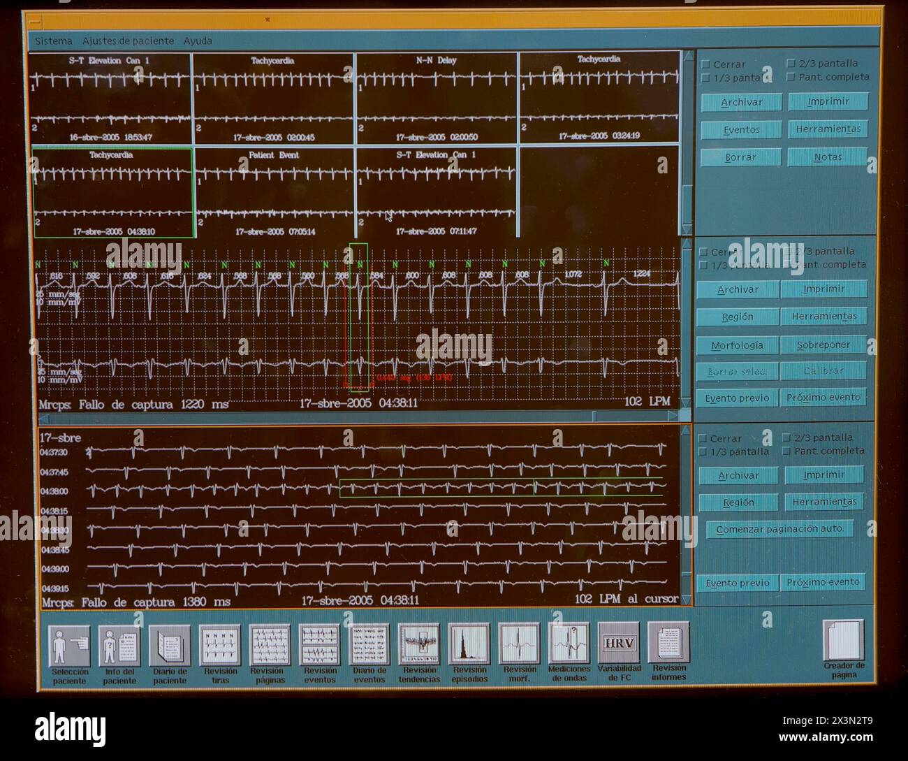 Holter-Monitoring, Hämodynamik. Krankenhaus Universitario Gran Canaria Arzt Negrin, Las Palmas de Gran Canaria. Kanarische Inseln, Spanien Stockfoto