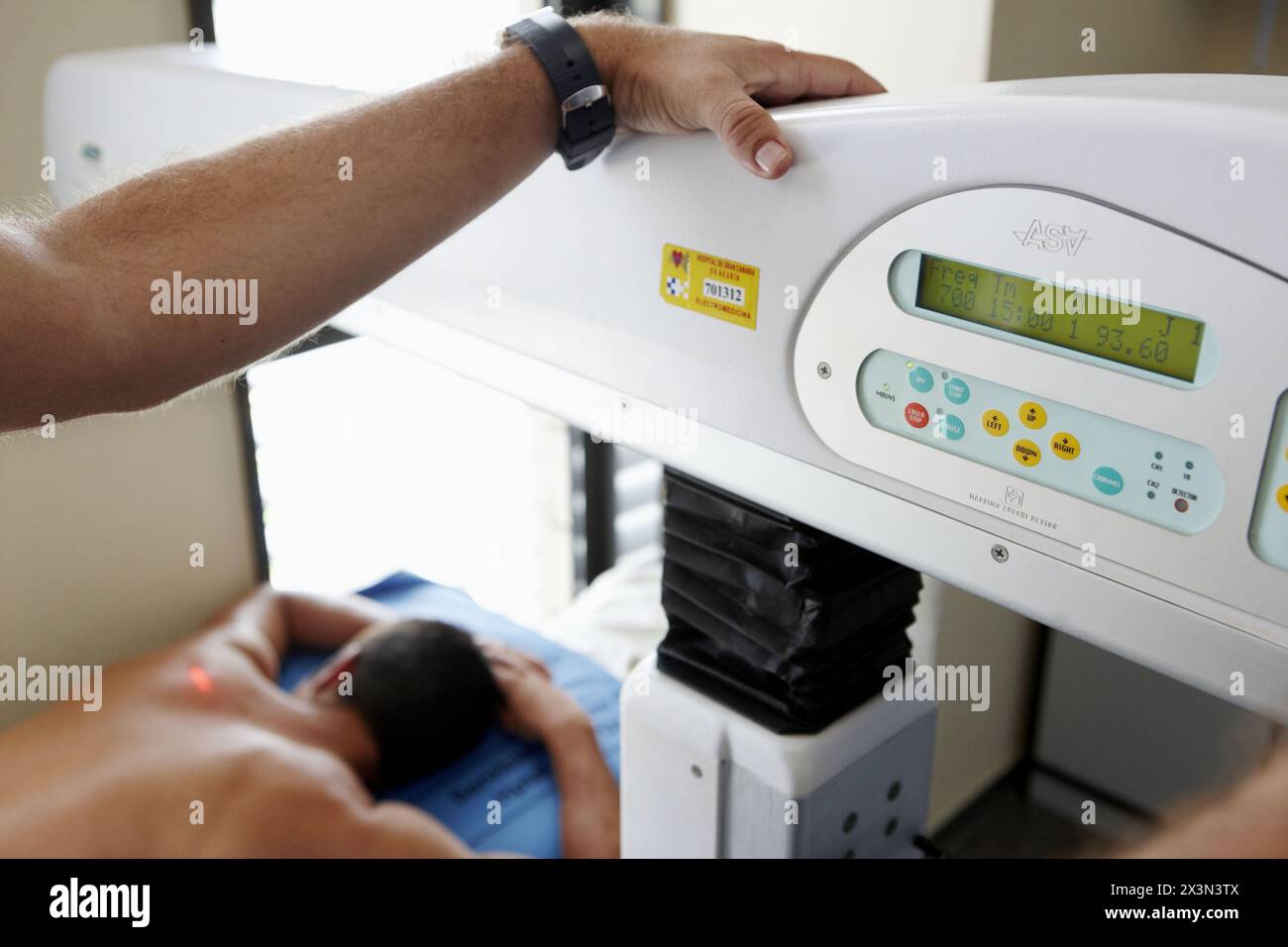 Rehabilitation, Lasertherapie erhöht den Zellstoffwechsel. Krankenhaus Universitario de Gran Canaria Arzt Negrin, Las Palmas de Gran Canaria. Kanarienvogel I Stockfoto