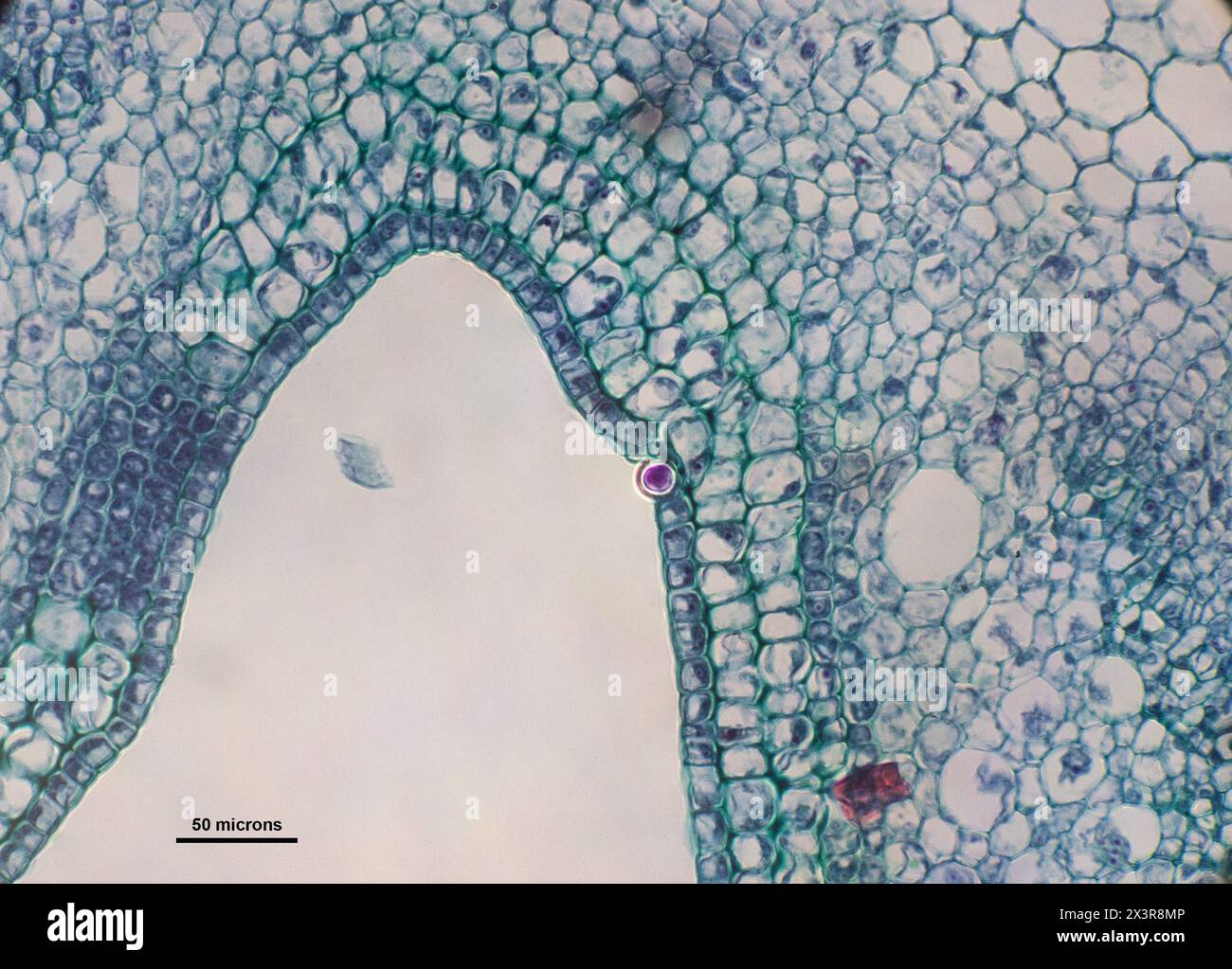 Querschnitt von Urtica-Zellen (Brennesseln) unter einem Mikroskop Stockfoto