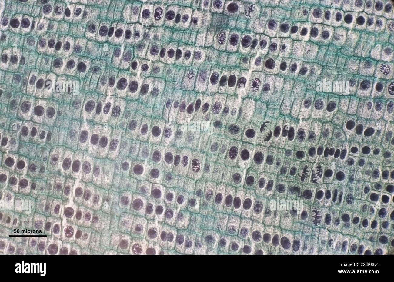 Zwiebelzellen unter einem Mikroskop bei 40-facher Vergrößerung (500 micros quer) Stockfoto