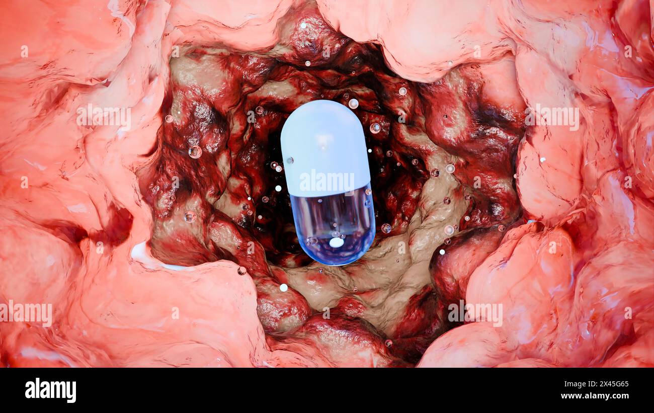 Probiotika im Darmtrakt. Endoskopie durch den Darm. Mikrobiota, Pille Kapsel mit Vitaminen für Verdauung, Magenschmerzen Behandlung, rot Stockfoto